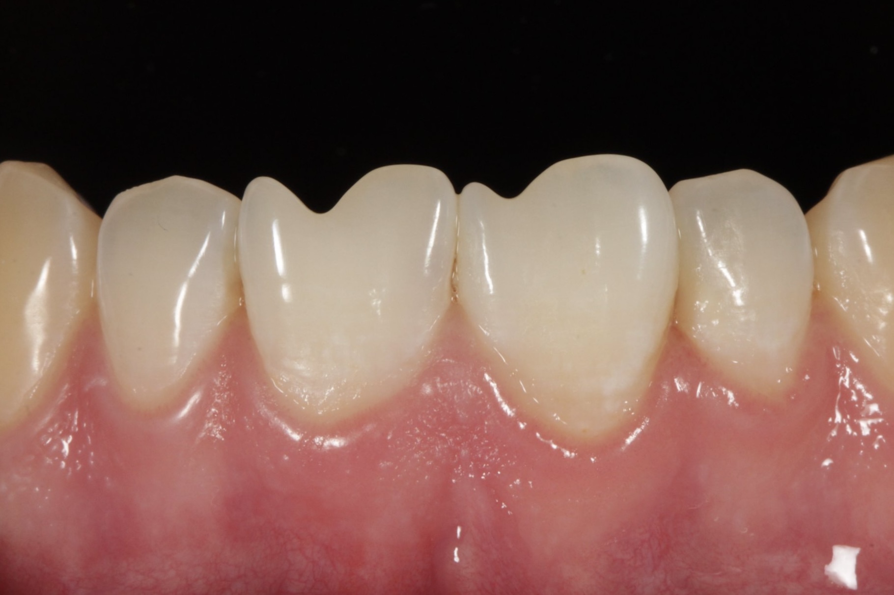 Фото до лікування — кейс 1