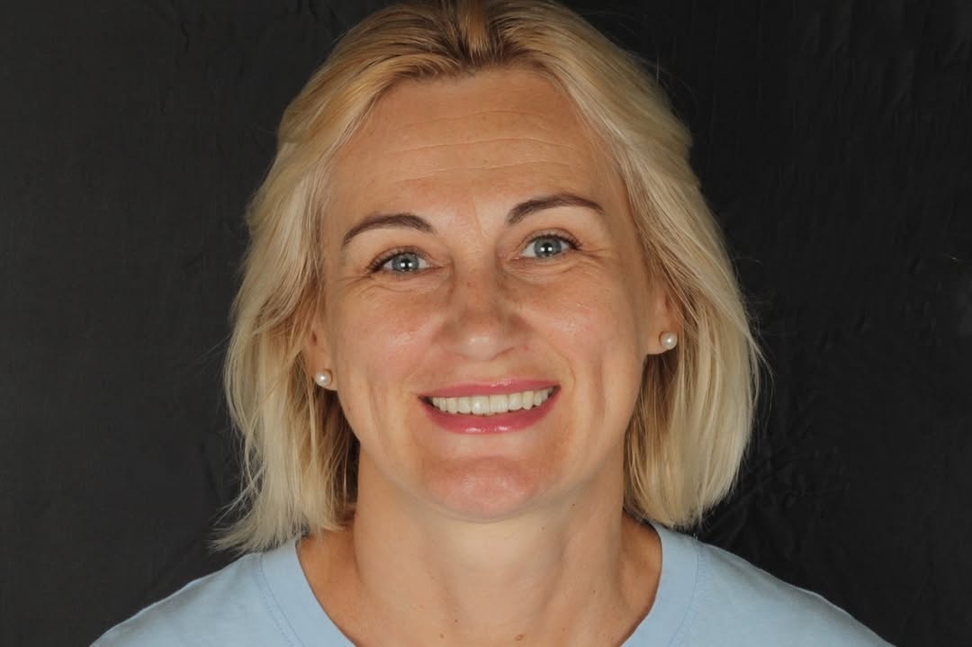 Фото після лікування — кейс 2