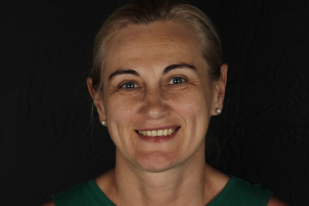 Фото до лікування — кейс 2