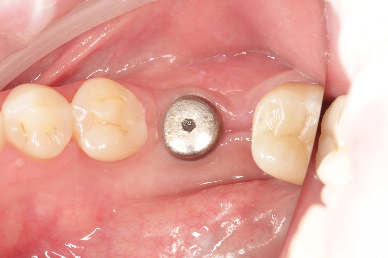 Фото до лікування — кейс 3