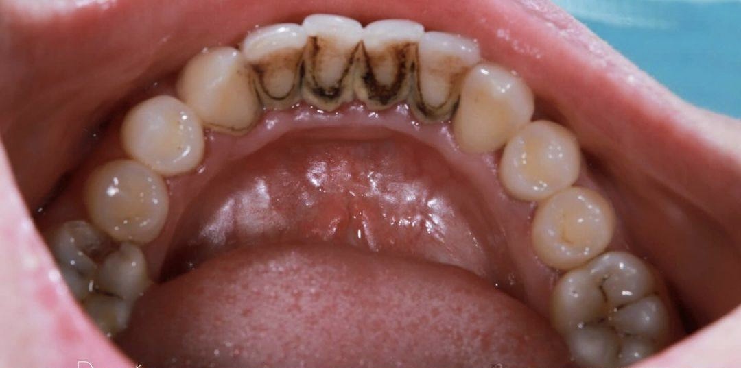 Фото до лікування — кейс 4