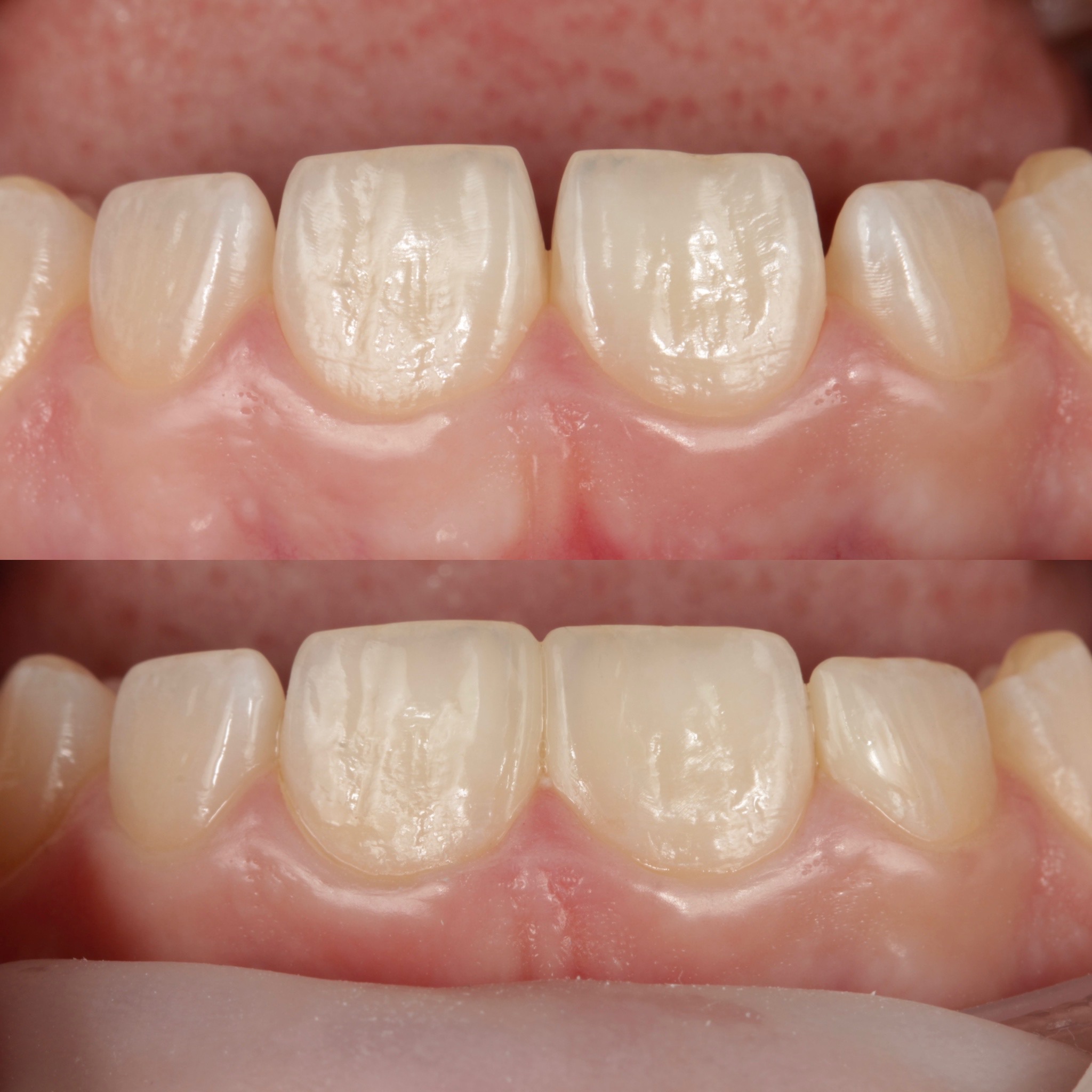 Результат лікування — до та після, кейс 8